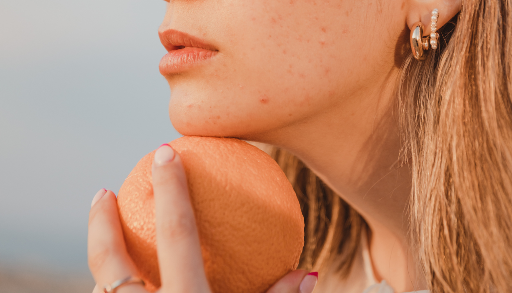 Mes astuces naturelles pour traiter un bouton